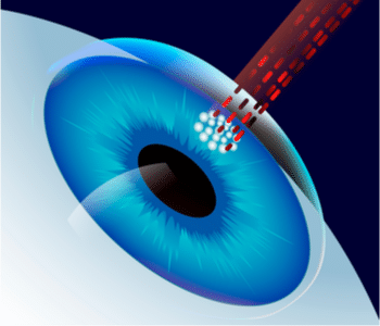 Real World Functional Vision Analysis