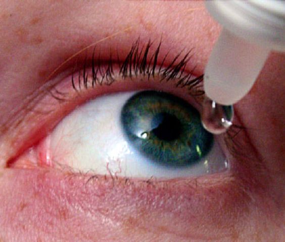 Dry Eyes and Mucosal Inflammation