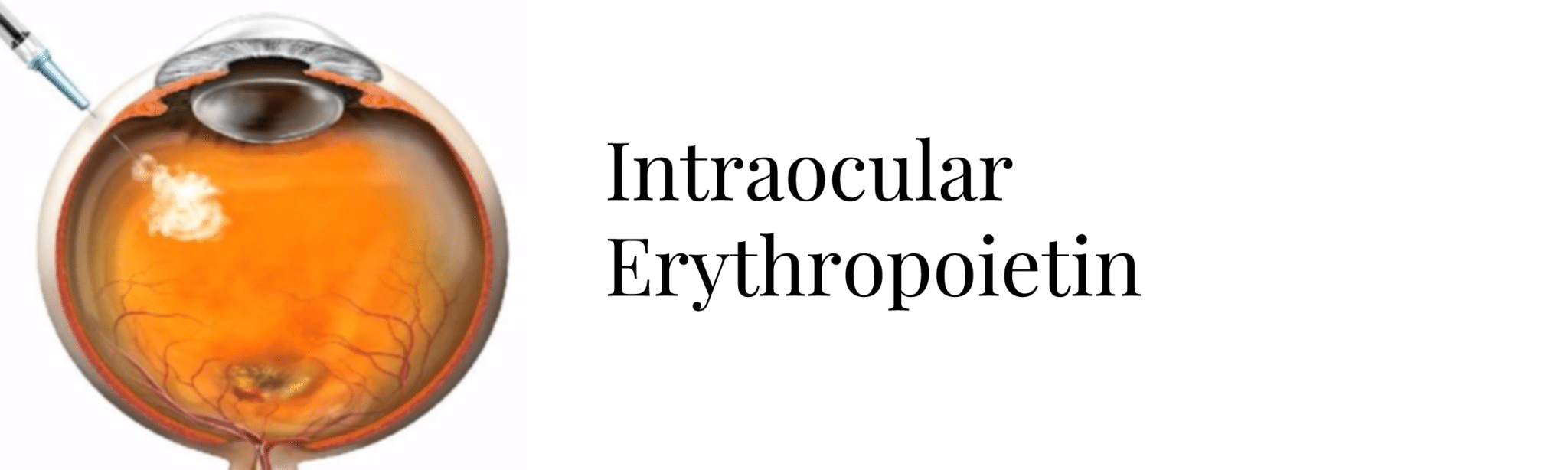 intraocular erythropoietin header