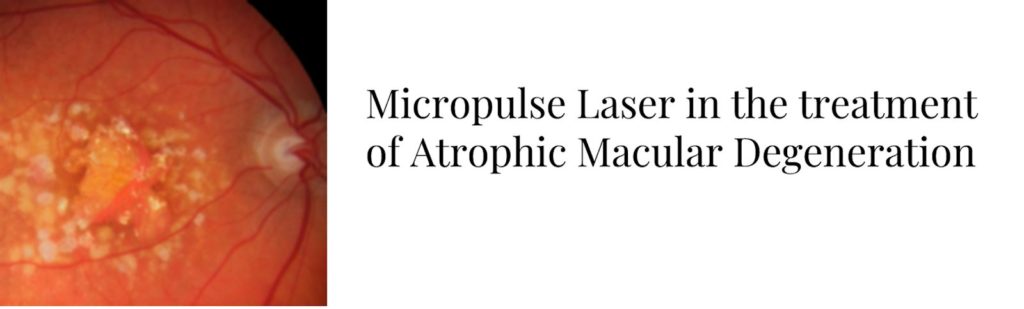 micropulse laser